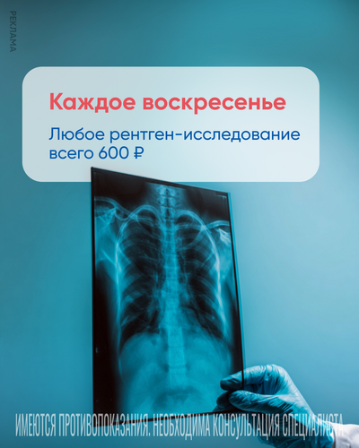 Рентген за 600 ₽ каждое воскресенье